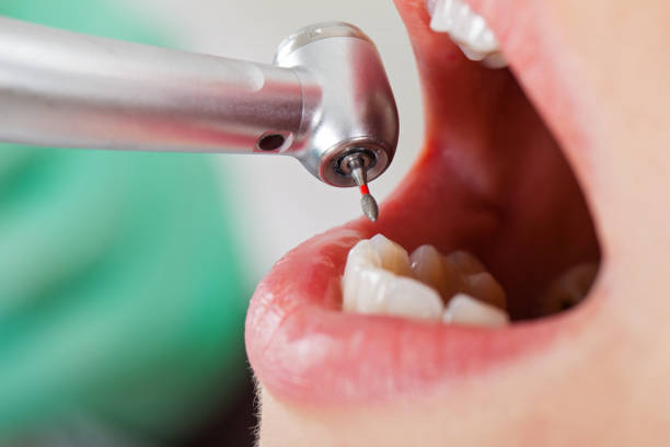 Best Emergency Root Canal Treatment in Eudora, AR